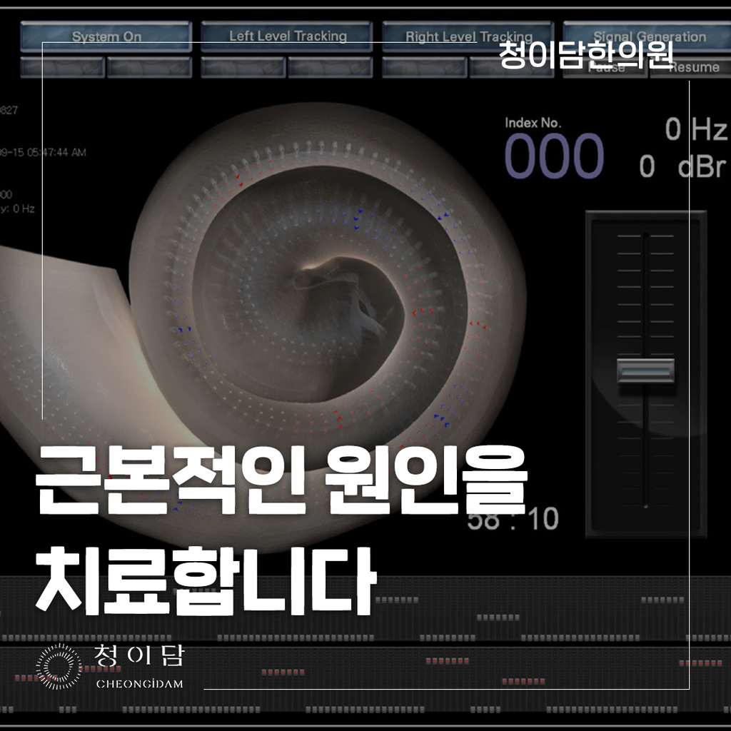 귀 삐소리